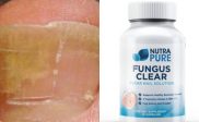 NutraPure Clear Fungus Review