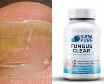 NutraPure Clear Fungus Review