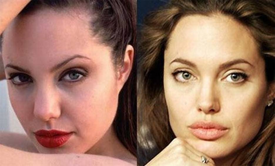 Angelina Jolie Before And After Plastic Surgery The Retelling Of Her Storied Career